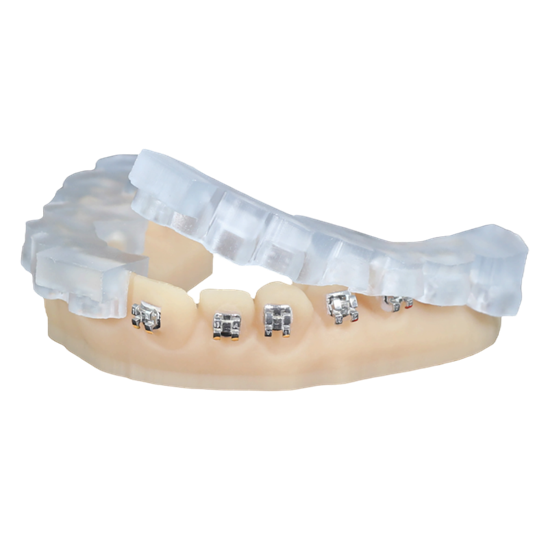 keyortho-ibt-for-envision.png